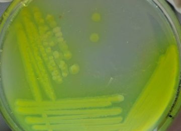 Servicios de análisis Microbiológicos 02